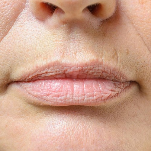 El secreto de una piel sin arrugas: ¡los tratamientos faciales más innovadores en Salón de Belleza Paquita! 