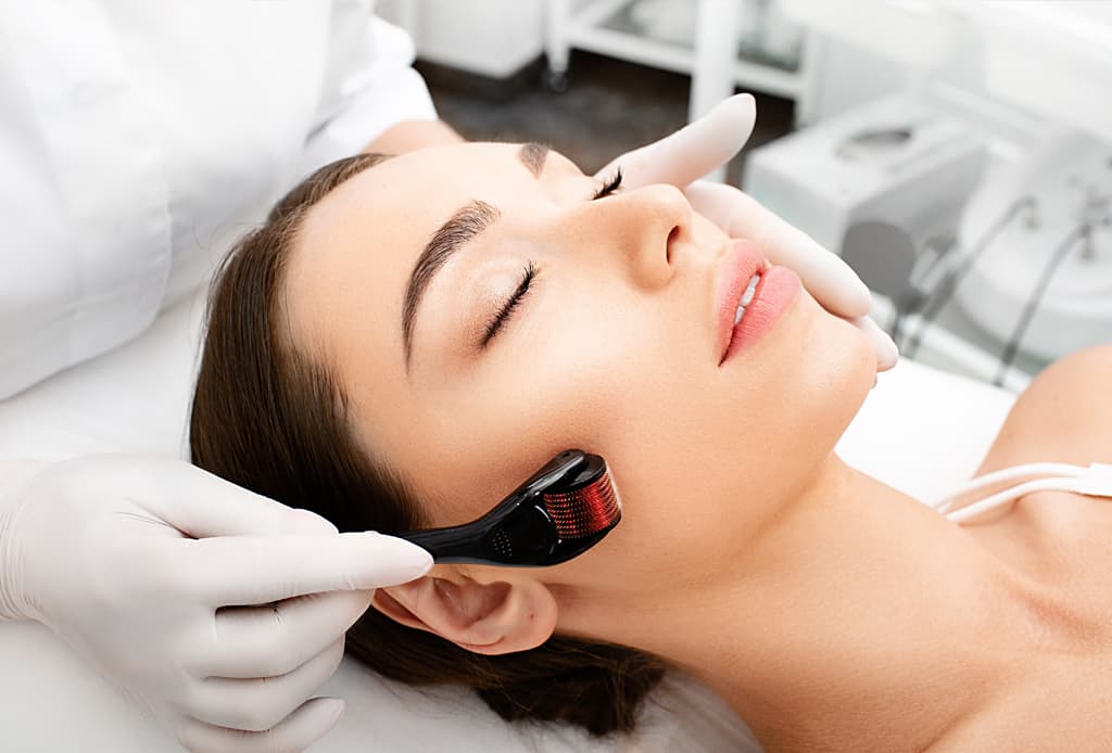 Micropunción con sistema Derma Roller en Vigo