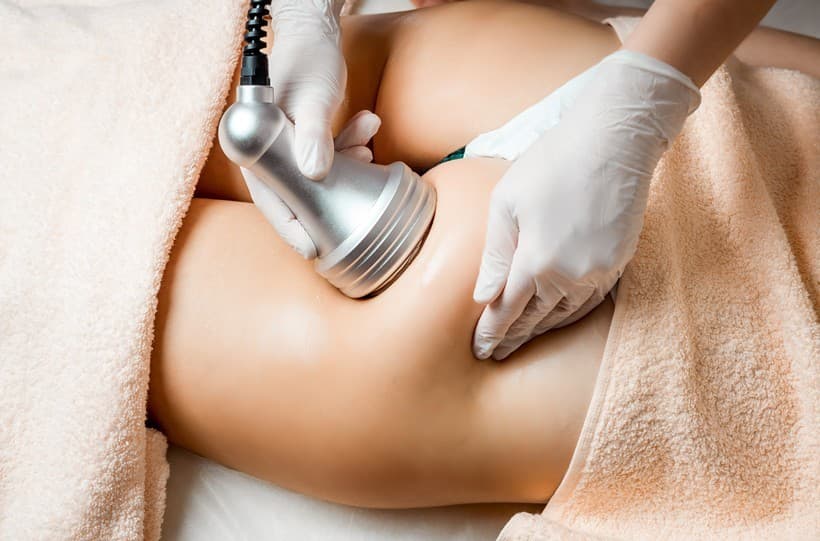 Liposuccion abdominal con laser en Vigo